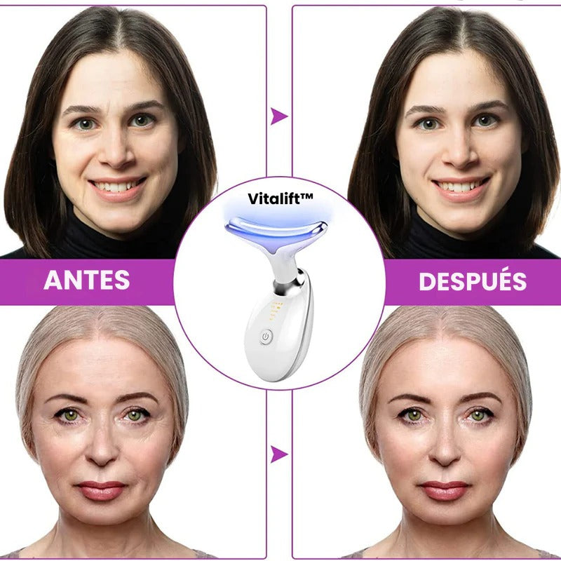 Masajeador facial antipapada CON LUZ LED